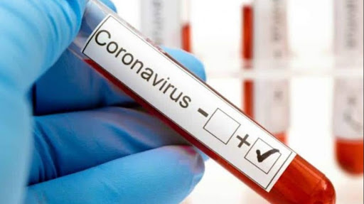 Confirman un caso positivo de coronavirus en Arrecifes